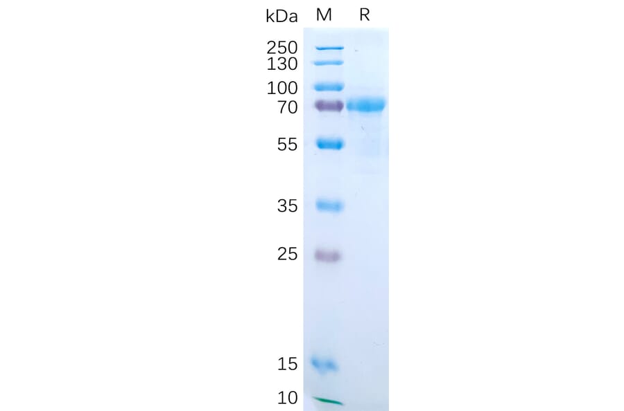 SDS-PAGE - Recombinant Human IL-15RA Protein (Fc Tag) (A318190) - Antibodies.com