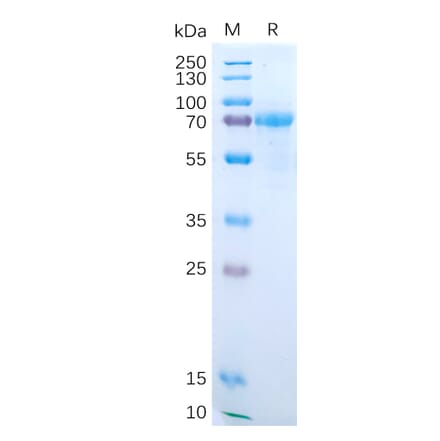 SDS-PAGE - Recombinant Human IL-15RA Protein (Fc Tag) (A318190) - Antibodies.com