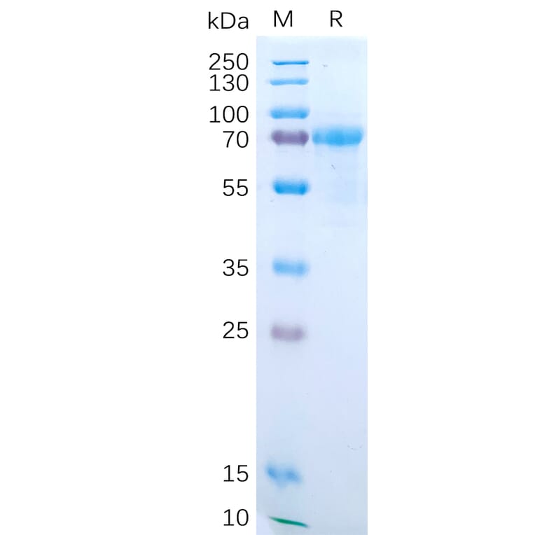 SDS-PAGE - Recombinant Human IL-15RA Protein (Fc Tag) (A318190) - Antibodies.com