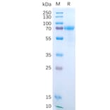 SDS-PAGE - Recombinant Human IL-15RA Protein (Fc Tag) (A318190) - Antibodies.com