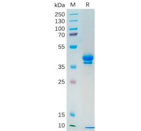 SDS-PAGE - Recombinant Human MUC1 Protein (Fc Tag) (A318191) - Antibodies.com