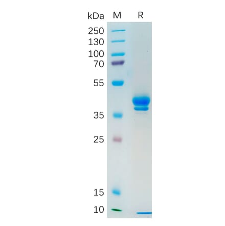 SDS-PAGE - Recombinant Human MUC1 Protein (Fc Tag) (A318191) - Antibodies.com