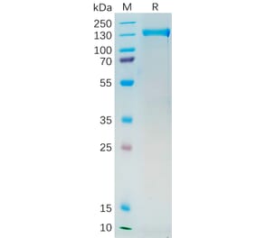 SDS-PAGE - Recombinant Human PSMA Protein (Fc Tag) (A318192) - Antibodies.com