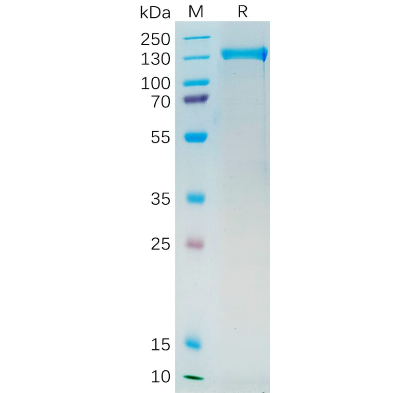 SDS-PAGE - Recombinant Human PSMA Protein (Fc Tag) (A318192) - Antibodies.com