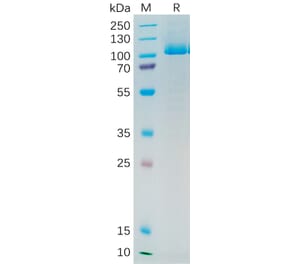 SDS-PAGE - Recombinant Human PSMA Protein (6×His Tag) (A318193) - Antibodies.com
