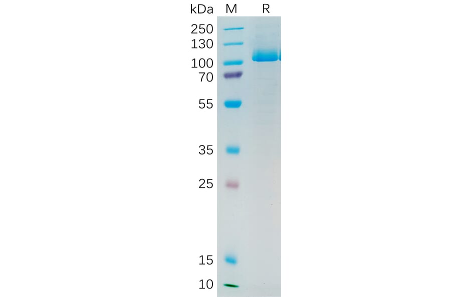 SDS-PAGE - Recombinant Human PSMA Protein (6×His Tag) (A318193) - Antibodies.com