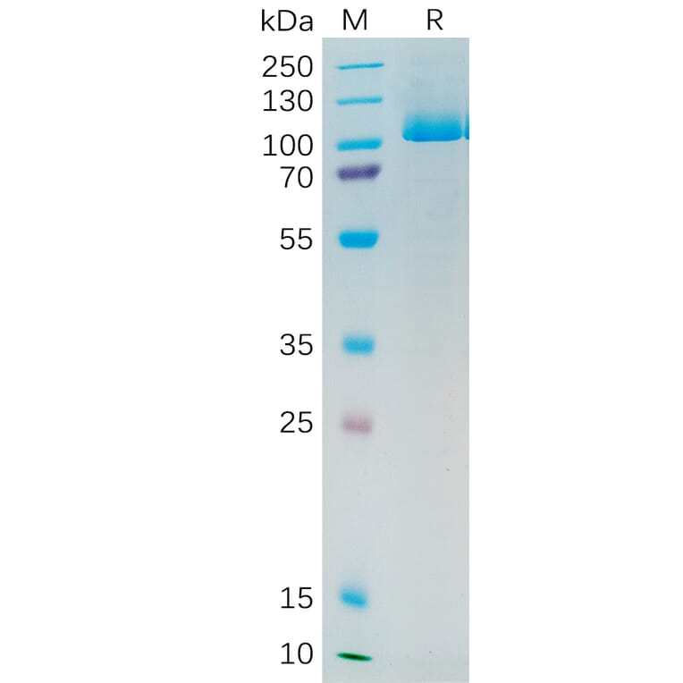 SDS-PAGE - Recombinant Human PSMA Protein (6×His Tag) (A318193) - Antibodies.com