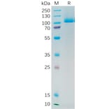 SDS-PAGE - Recombinant Human PSMA Protein (6×His Tag) (A318193) - Antibodies.com