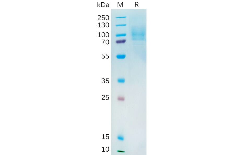 SDS-PAGE - Recombinant Human YAP1 Protein (6×His Tag) (A318194) - Antibodies.com