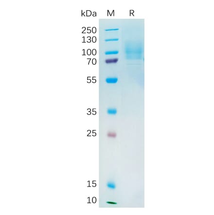 SDS-PAGE - Recombinant Human YAP1 Protein (6×His Tag) (A318194) - Antibodies.com