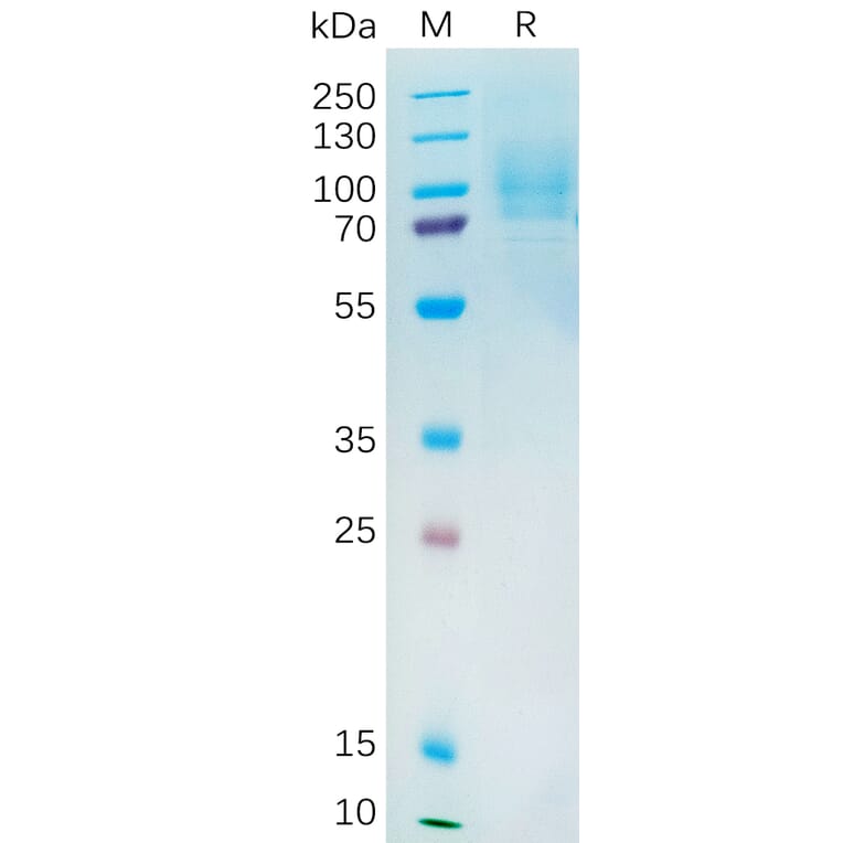 SDS-PAGE - Recombinant Human YAP1 Protein (6×His Tag) (A318194) - Antibodies.com