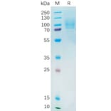 SDS-PAGE - Recombinant Human YAP1 Protein (6×His Tag) (A318194) - Antibodies.com