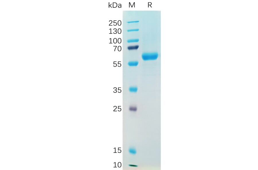 SDS-PAGE - Recombinant SARS-CoV-2 Spike Glycoprotein RBD (Alpha B.1.1.7 Variant) (Fc Tag) (A318195) - Antibodies.com