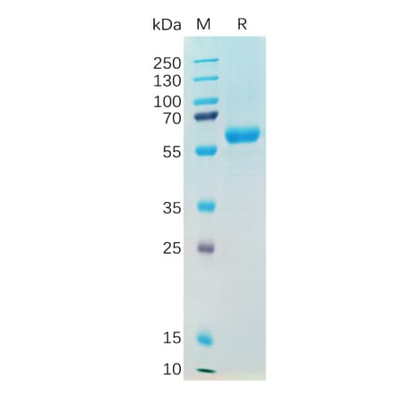 SDS-PAGE - Recombinant SARS-CoV-2 Spike Glycoprotein RBD (Alpha B.1.1.7 Variant) (Fc Tag) (A318195) - Antibodies.com
