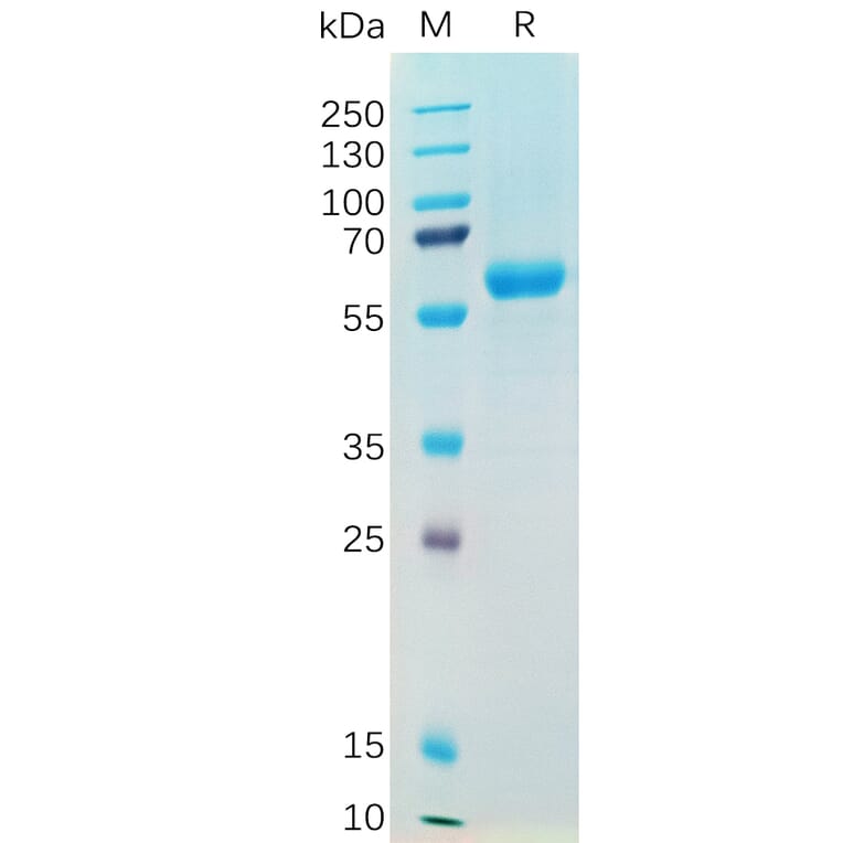 SDS-PAGE - Recombinant SARS-CoV-2 Spike Glycoprotein RBD (Alpha B.1.1.7 Variant) (Fc Tag) (A318195) - Antibodies.com