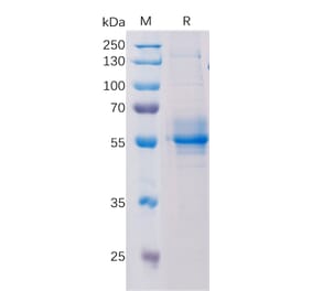 SDS-PAGE - Recombinant Human STING Protein (Fc Tag) (A318196) - Antibodies.com