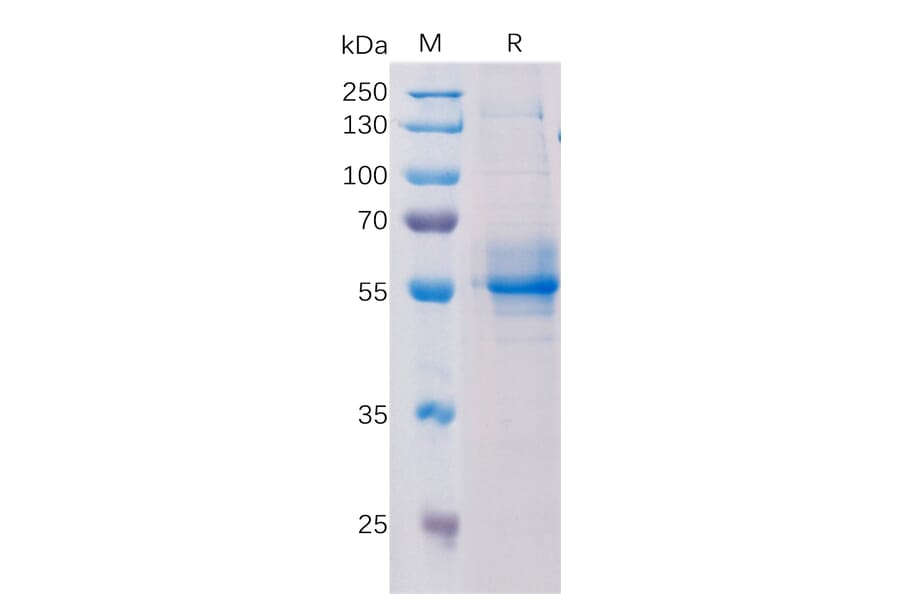 SDS-PAGE - Recombinant Human STING Protein (Fc Tag) (A318196) - Antibodies.com