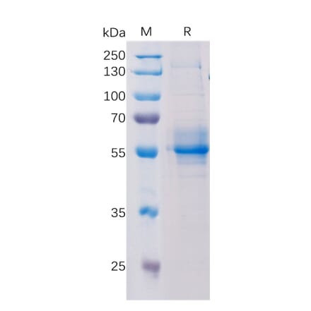 SDS-PAGE - Recombinant Human STING Protein (Fc Tag) (A318196) - Antibodies.com