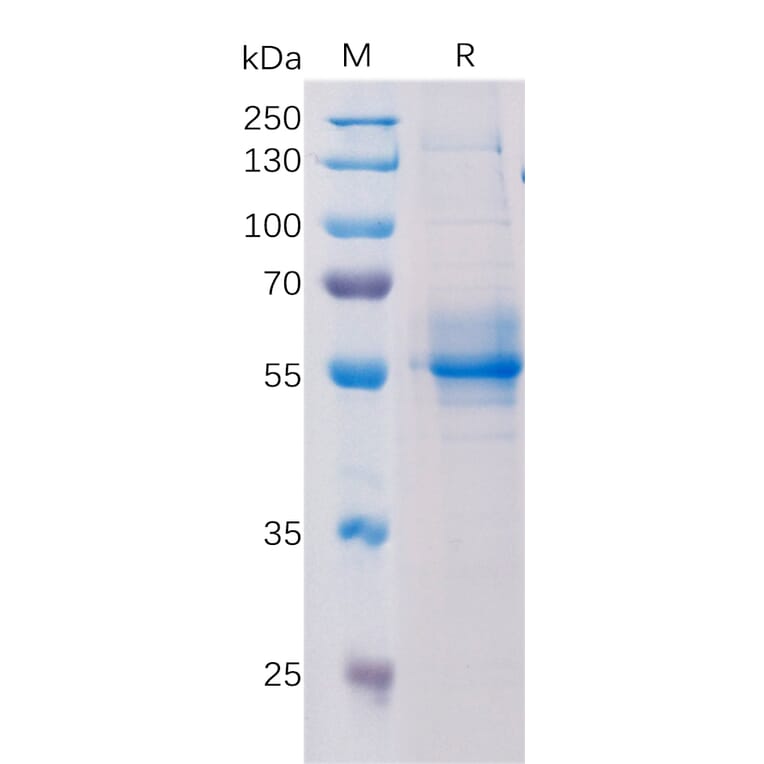 SDS-PAGE - Recombinant Human STING Protein (Fc Tag) (A318196) - Antibodies.com