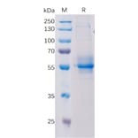 SDS-PAGE - Recombinant Human STING Protein (Fc Tag) (A318196) - Antibodies.com