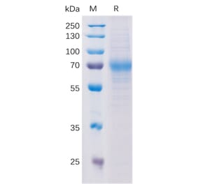 SDS-PAGE - Recombinant Human CD229 Protein (6×His Tag) (A318197) - Antibodies.com