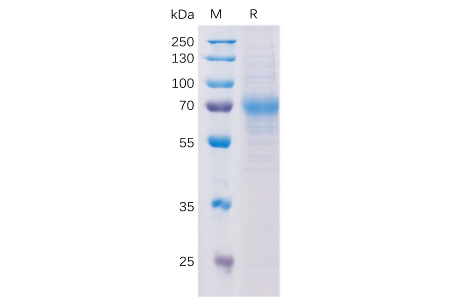 SDS-PAGE - Recombinant Human NCAM1 Protein (Fc Tag) (A318198) - Antibodies.com