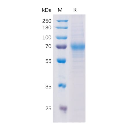SDS-PAGE - Recombinant Human NCAM1 Protein (Fc Tag) (A318198) - Antibodies.com