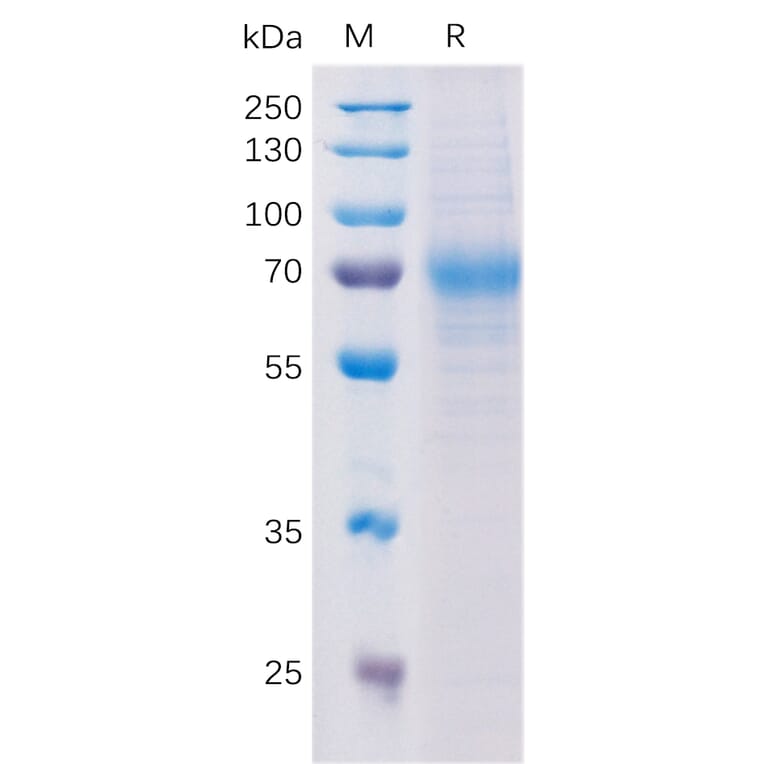 SDS-PAGE - Recombinant Human NCAM1 Protein (Fc Tag) (A318198) - Antibodies.com