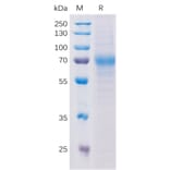 SDS-PAGE - Recombinant Human NCAM1 Protein (Fc Tag) (A318198) - Antibodies.com