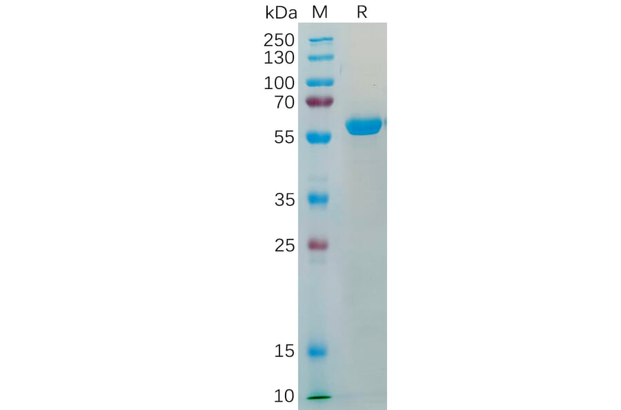 SDS-PAGE - Recombinant SARS-CoV-2 Spike Glycoprotein RBD (Beta B.1.351 Variant) (Fc Tag) (A318199) - Antibodies.com