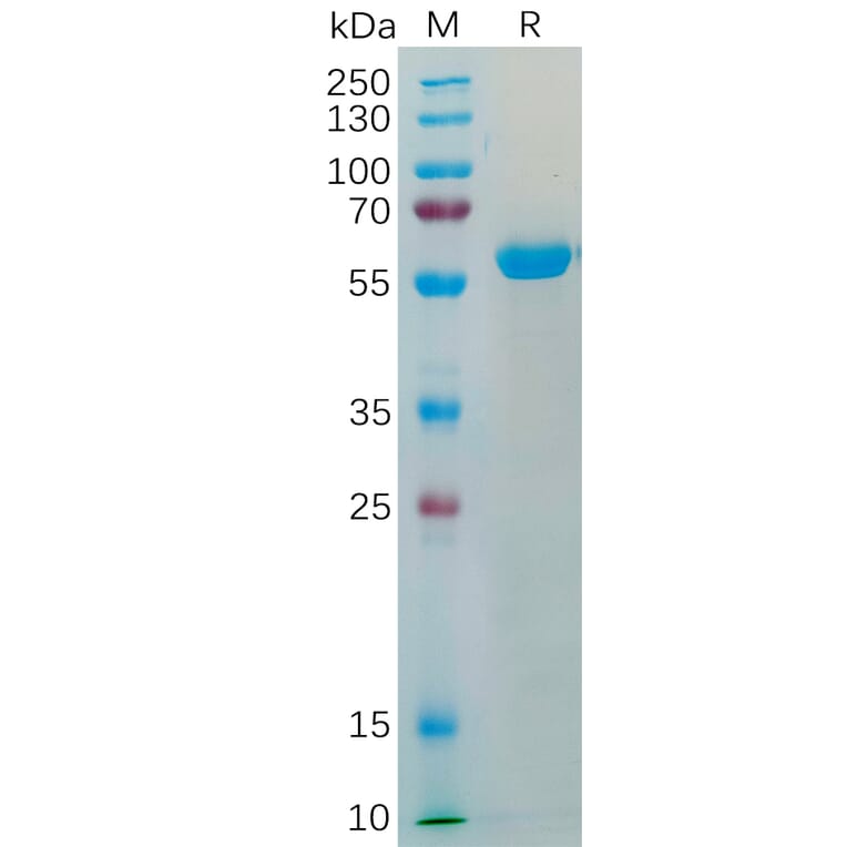 SDS-PAGE - Recombinant SARS-CoV-2 Spike Glycoprotein RBD (Beta B.1.351 Variant) (Fc Tag) (A318199) - Antibodies.com