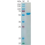 SDS-PAGE - Recombinant SARS-CoV-2 Spike Glycoprotein RBD (Beta B.1.351 Variant) (Fc Tag) (A318199) - Antibodies.com