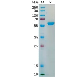 SDS-PAGE - Recombinant Human Transmembrane 4 L6 Family Member 1 Protein (Fc Tag) (A318200) - Antibodies.com