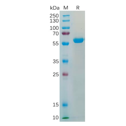 SDS-PAGE - Recombinant Human Transmembrane 4 L6 Family Member 1 Protein (Fc Tag) (A318200) - Antibodies.com