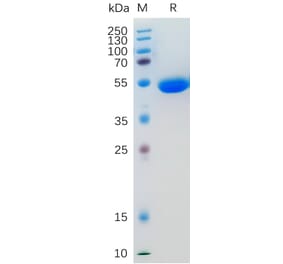SDS-PAGE - Recombinant Human IL-5 Protein (Fc Tag) (A318201) - Antibodies.com