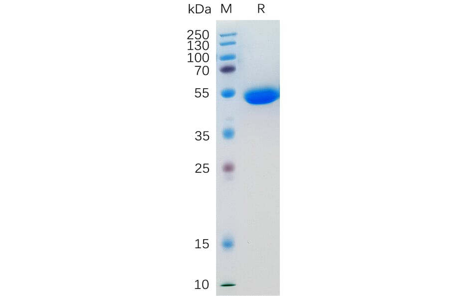 SDS-PAGE - Recombinant Human IL-5 Protein (Fc Tag) (A318201) - Antibodies.com