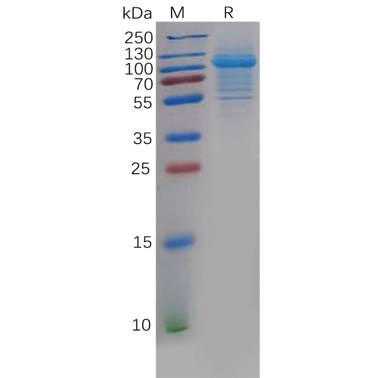 SDS-PAGE - Recombinant Human IL-5RA Protein (Fc Tag) (A318202) - Antibodies.com