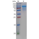 SDS-PAGE - Recombinant Human IL-5RA Protein (Fc Tag) (A318202) - Antibodies.com