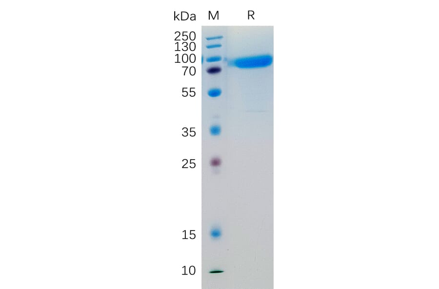 SDS-PAGE - Recombinant Human IL-6R Protein (Fc Tag) (A318203) - Antibodies.com