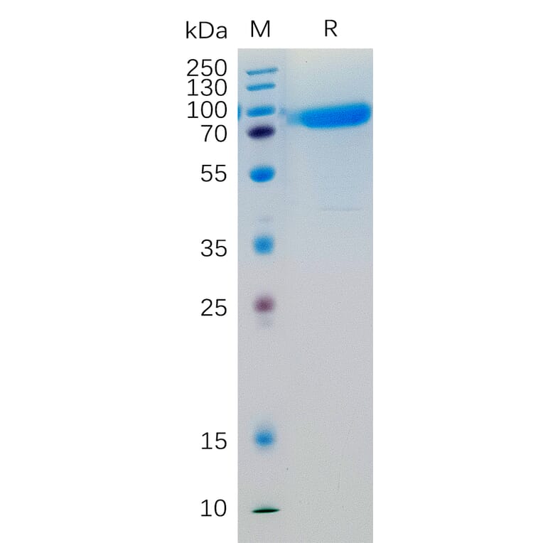 SDS-PAGE - Recombinant Human IL-6R Protein (Fc Tag) (A318203) - Antibodies.com