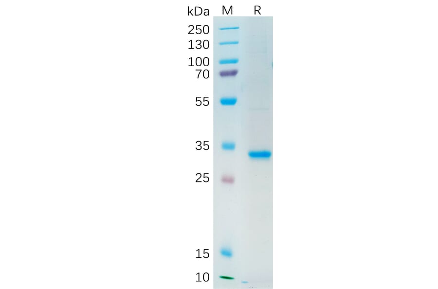 SDS-PAGE - Recombinant Human SFRP2 Protein (6×His Tag) (A318204) - Antibodies.com