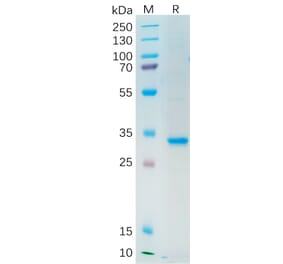 SDS-PAGE - Recombinant Human Axl Protein (Fc Tag) (A318205) - Antibodies.com