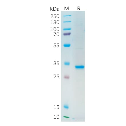 SDS-PAGE - Recombinant Human Axl Protein (Fc Tag) (A318205) - Antibodies.com