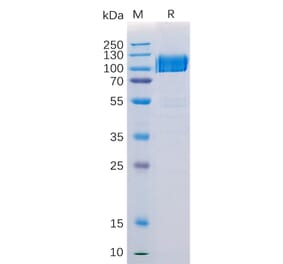 SDS-PAGE - Recombinant Human Axl Protein (Fc Tag) (A318206) - Antibodies.com