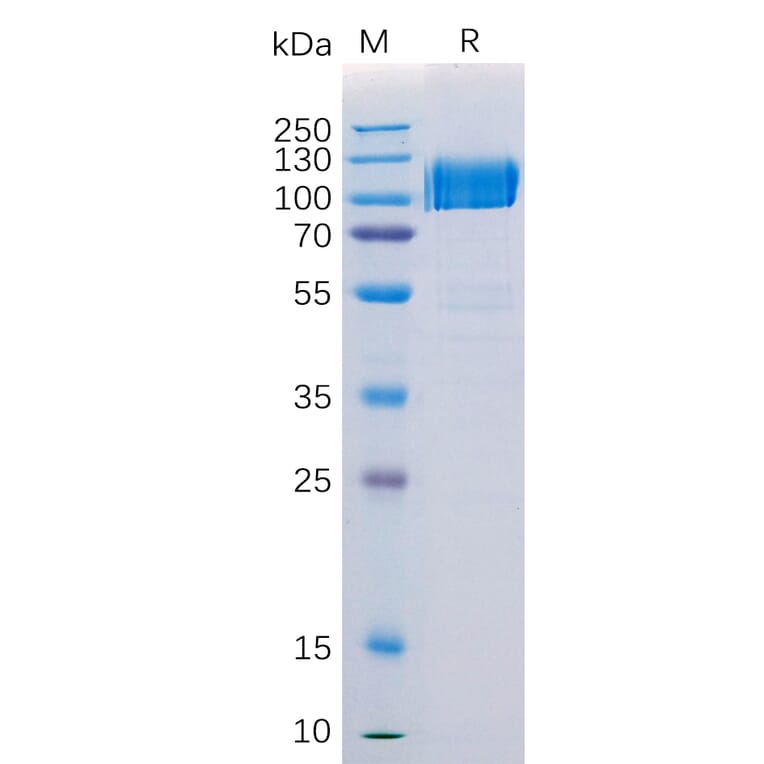 SDS-PAGE - Recombinant Human Axl Protein (Fc Tag) (A318206) - Antibodies.com