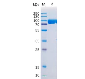 SDS-PAGE - Recombinant Human SIRP alpha Protein (Fc Tag) (A318207) - Antibodies.com