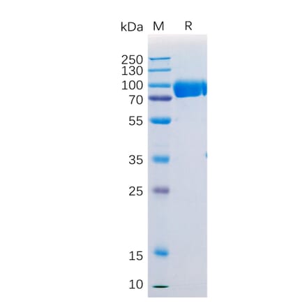 SDS-PAGE - Recombinant Human SIRP alpha Protein (Fc Tag) (A318207) - Antibodies.com