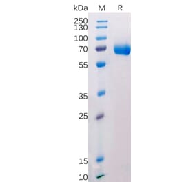 SDS-PAGE - Recombinant Human CD38 Protein (Fc Tag) (A318208) - Antibodies.com