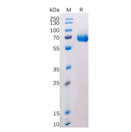 SDS-PAGE - Recombinant Human CD38 Protein (Fc Tag) (A318208) - Antibodies.com