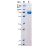 SDS-PAGE - Recombinant Human CD38 Protein (Fc Tag) (A318208) - Antibodies.com